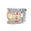 TM-C2 Edentulous Pathology Model for Dental Teaching